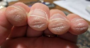 image: wrong guitar strings hurt fingers-guitarist-fingers-guitar hard to play and guitar action too high